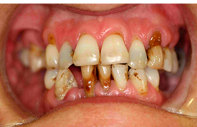 Estética antes 2