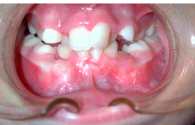 Odontologia lehen