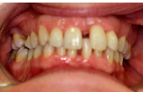 Odontologia lehen