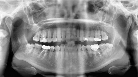 Foto radiografia